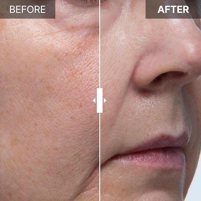 FRANZ Stem Care 30% Ampoule Serum for Face | Deep Hydration, Firming, Lifting | Reduces Fine Lines & Wrinkles | Advanced Korean Skincare (0.034 fl.oz.)