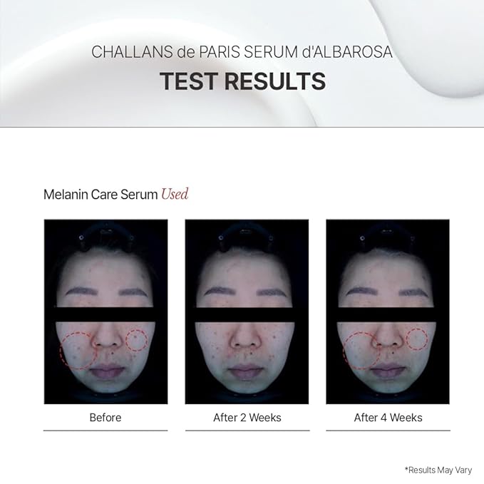 [CHALLANS de PARIS] Ampoule de Albarosa Dark Spot Care Serum – Sun Damage Repair, Brightening & Hydration, Face Ampoule for Even Skin Tone, Lightweight Korean Skincare, 1.23 fl oz