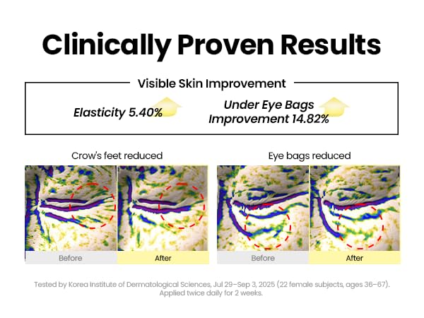 K-SECRET SEOUL 1988 Retinal Eye Cream – Formulated with Advanced Retinal Liposome 4% and Fermented Bean for Dark Circles and Fine Line Care | Korean Skincare, 30ml / 1.01 fl oz