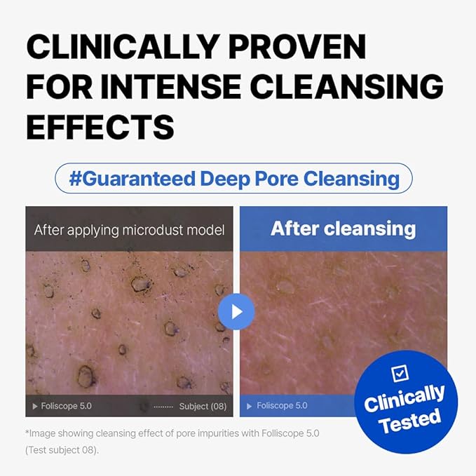 MAKE P:REM Safe Me. Amino Refresh Cleansing Balm, Gentle Makeup Remover for Deep Cleansing, Removes Blackheads, Eye-Safe Cleanser, Korean Skin Care, 3.38 Fl Oz, 100ml