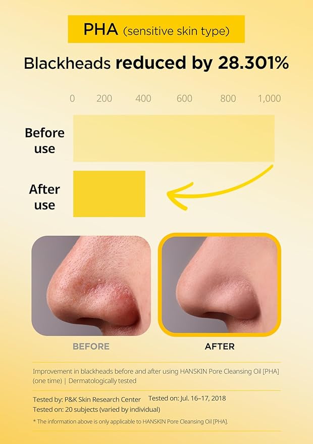 Hanskin Glass Essentials Set – PHA Pore Cleansing Oil, Hyaluron Skin Essence & Moisture Cream | Hydration, Pore Care & Exfoliation for All Skin Types | Korean Skincare Set, K-Beauty