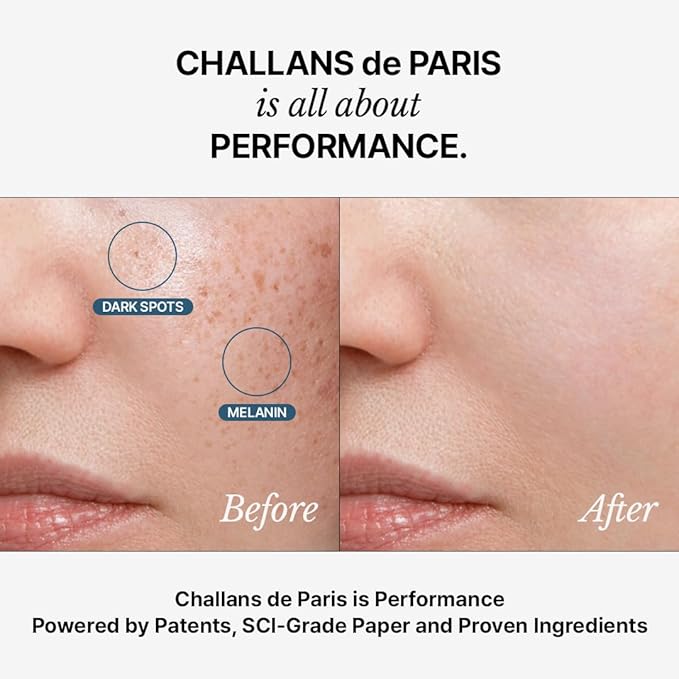 [CHALLANS de PARIS] Ampoule de Albarosa Dark Spot Care Serum – Sun Damage Repair, Brightening & Hydration, Face Ampoule for Even Skin Tone, Lightweight Korean Skincare, 1.23 fl oz