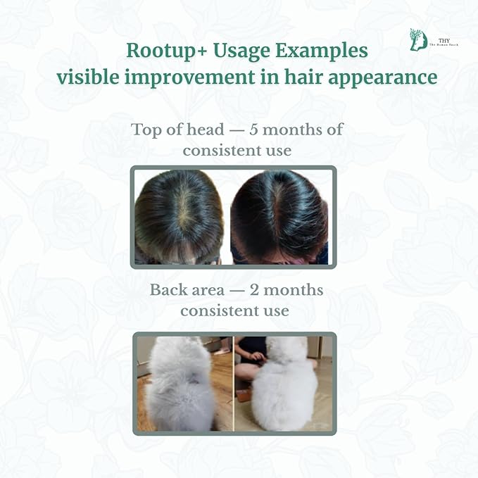 [THY rootup+] Botanical Hair Tonic – Herbal Scalp Spray for Fuller-Looking Hair | Non-Greasy Formula with Korean Plant-Based Formula | For Men & Women |250 ml / 8.45 fl oz