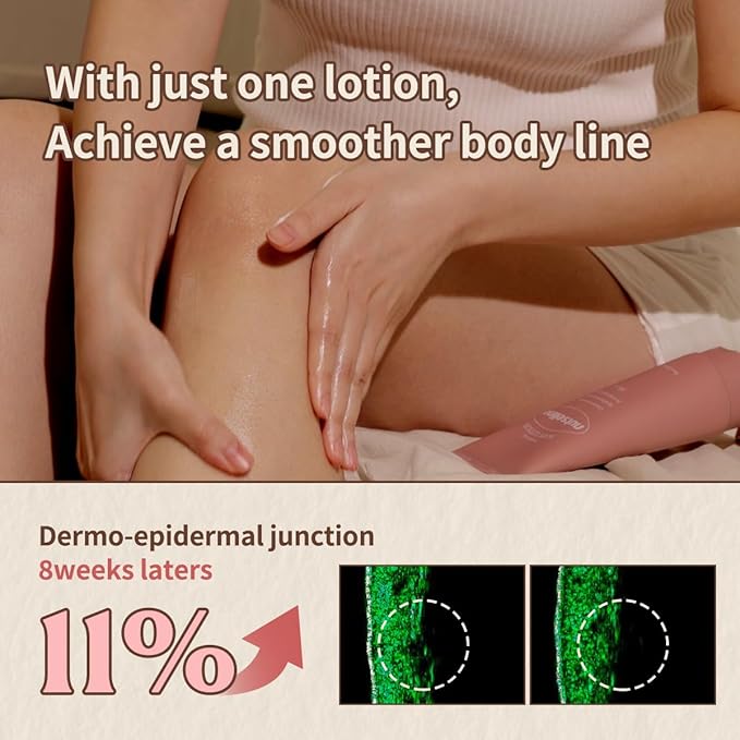 Aroma Nut Slim Fit Body Lotion-Korean Skin Care with 11 Aroma Essential Oils Extract, Anti-Cellutile Lotion, Natural Aroma Scent, Gluten-Free(200ml / 6.76 fl oz.)