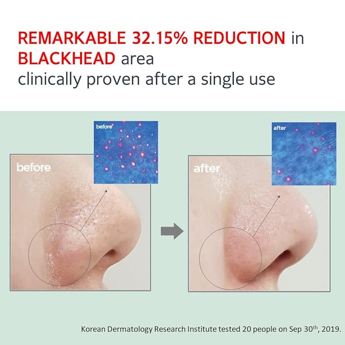 MAKE P:REM Safe Me. Relief Moisture Cleansing Oil, Deep Pore Cleansing Makeup Remover for Oily Skin, All Skin Types, Gentle Blackhead Remover, Korean Skin Care, 7.1 fl.oz. (210ml)