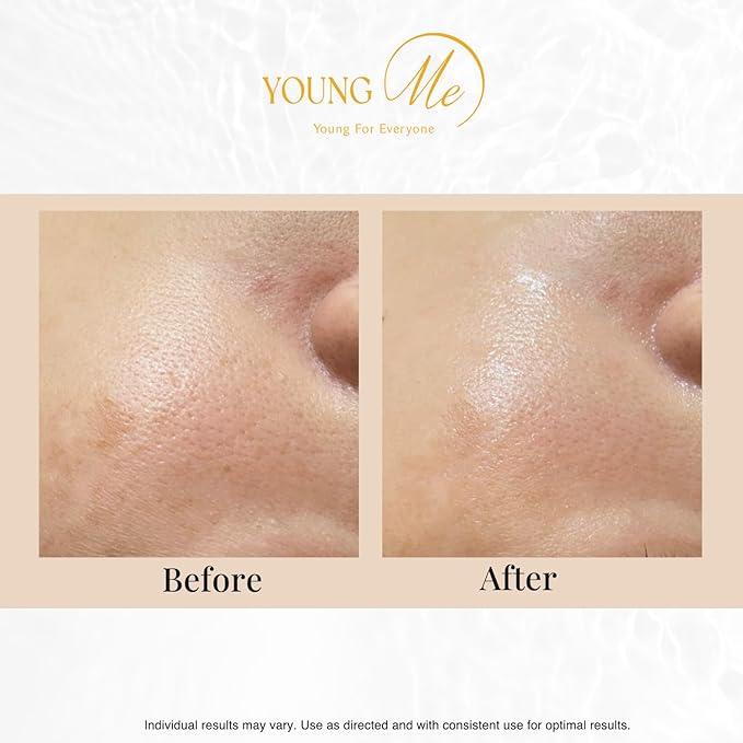 YoungMe Radiant Glamour Korean Sheet Mask – Rejuvenating & Hypoallergenic Facial Mask for All Skin Types | 25g x 6 Sheets