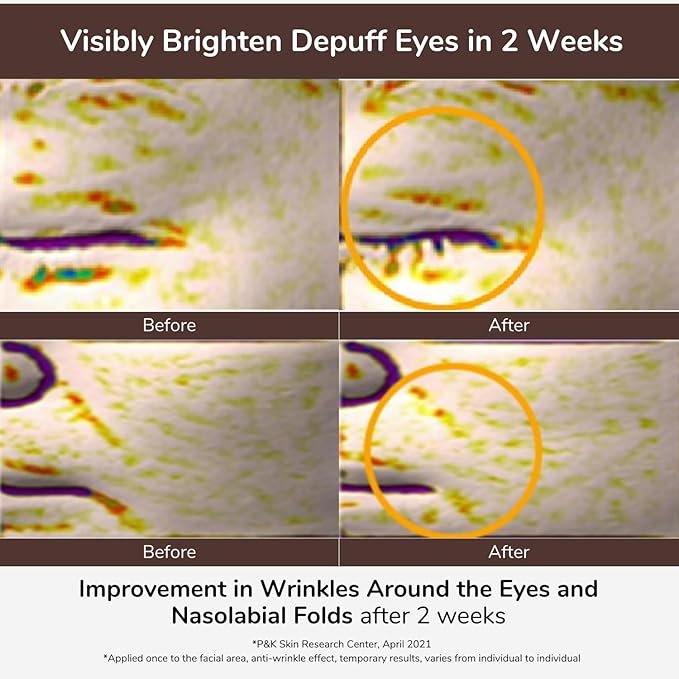 Elensilia 80% Collagen With Gold Peptides Eye Cream - Snail Secretion Filtrate + Matrixyl 3000 + Haloxyl For Wrinkles, Dark Circles, Moisturizer - Korean Skin Care, 0.7 fl.oz