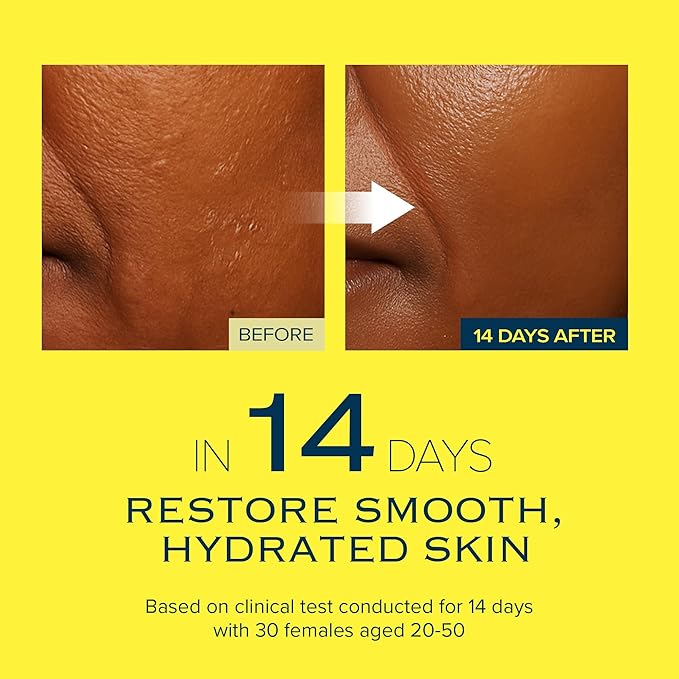 Glow Reset Toner | Korean Clinic Skincare - Thioctic Acid & Niacinamide 5% | Gentle Exfoliation w/Pumpkin Extract | Fades Dark Spots & Acne Scars | Deep Hydration | 250ml /8.45 Fl Oz