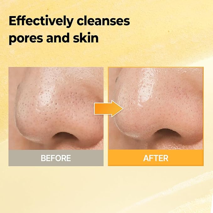 CHOSUNGAH BEAUTY Lemon Chung Bubble Cleanser with Salicylic Acid, LHA&PHA, Gentle Foaming Face Wash for Oily, Dry&Sensitive Skin, Hydrating&Exfoliating Formula, Korean Skincare (6.76 Fl Oz)