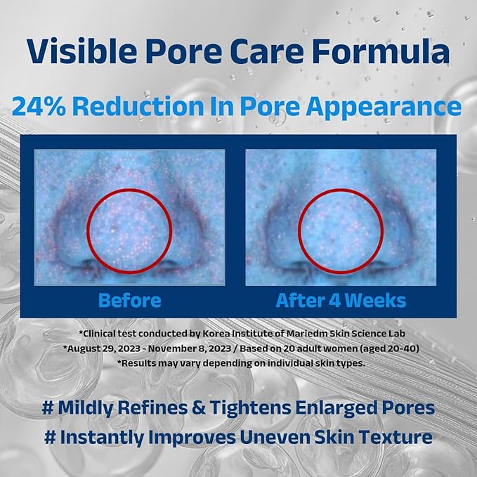 ACNIOME Derma Moisture Cream, Salicylic Acid Daily Pore-Care Gel Cream, Hydrating Non-Sticky Moisturizer with Hyaluronic Acid for Oily & Sensitive Skin, Korean Skincare (1.69 Fl Oz)