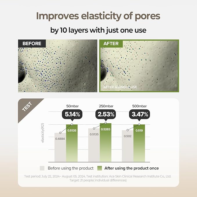 SKINFOOD Rice Starter Kit, Rice Toner, Rice Serum, Rice Moisturizer, and Rice Face Wash for Glass Skin, Korean Skin Care Set, Travel Size Kit, Stocking Stuffers, Gift Set for Women, Skincare Gift Set