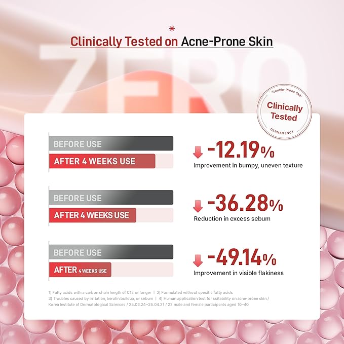 Zeroca 81 Serum – Korean Wild Rose Serum for Acne-Prone & Sensitive Skin – Balances Oil-Water, Soothes Redness, Fades Post-Blemish Marks, Firms & Hydrates 1.01 oz. 30 ml