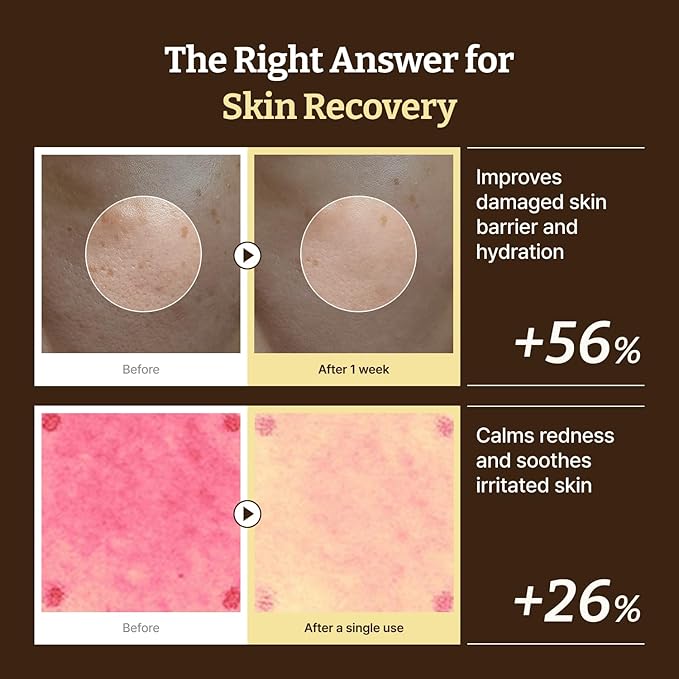 Dr. Reju-All The Anti-Aging Routine Set: Advanced PDRN Rejuvenating Cream + Retino-Mela Serum + LC-Ceramide Barrier Cream - All-in-one Korean Pharmacy Skin Care for All Skin Types