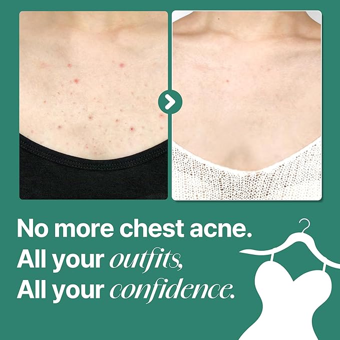 SOME BY MI AHA BHA PHA 30 Days Miracle Acne Clear Body Cleanser – Pack of 2 – Daily Exfoliating Tea Tree & Salicylic Acid Acne Body Wash – Deep Cleanses Sebum, Oil & Impurities – Korean Skin Care