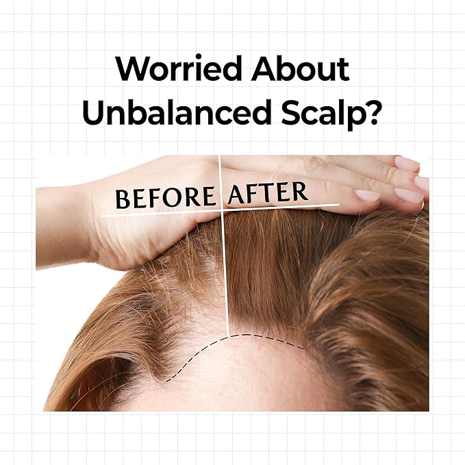 KUNDAL Shampoo/Conditioner + Hair Loss Serum Roll On Set, Sulfate Free Moisture Care, 10X Caffeine Scalp Strengthening, Korean Hair Care + Amber Vanilla, 16.9 fl oz x2 + 0.33 fl oz