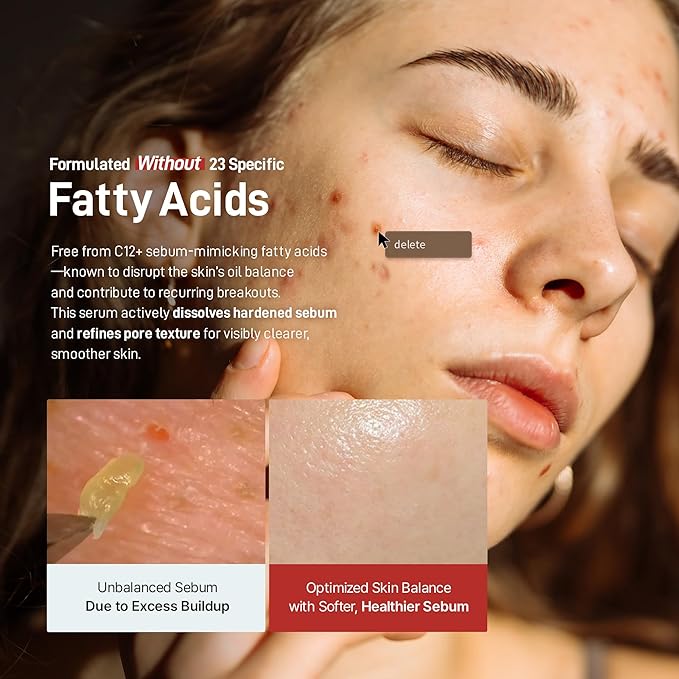 Zeroca 81 Serum – Korean Wild Rose Serum for Acne-Prone & Sensitive Skin – Balances Oil-Water, Soothes Redness, Fades Post-Blemish Marks, Firms & Hydrates 1.01 oz. 30 ml