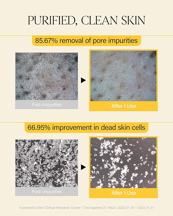 About Me Rice Makgeolli Cleansing Oil – Korean Makeup Remover Cleanser for Sensitive Skin – Daily Makeup Removal with Rice Bran Oil – Korean Skin Care – 6.59oz, 195ml