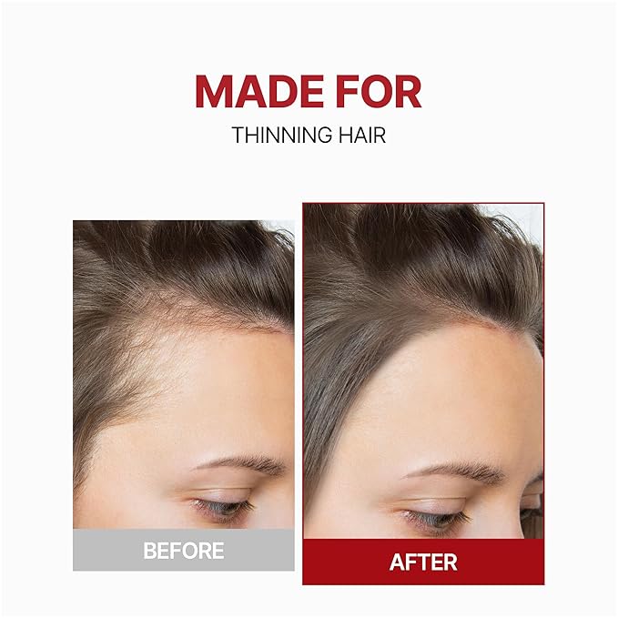 KUNDAL Shampoo/Conditioner + Caffeine Scalp Tonic Set, Sulfate Free Moisture Care, Hair Loss Scalp Strengthening, Korean Hair Care + Baby Powder, 16.9 fl oz x2 + 3.38 fl oz