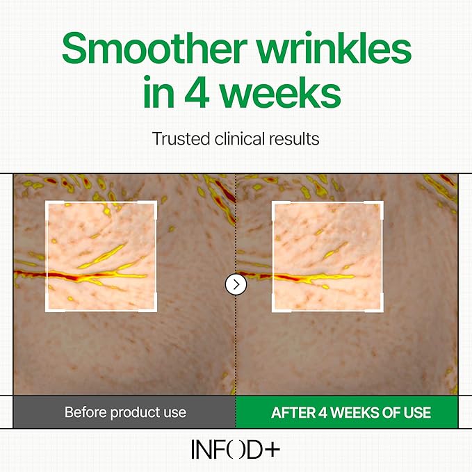 INFODPLUS Korean Skin Care Sensitive Face Cream, Fragrance-Free Lightweight Moisturizer with Ceramides & Panthenol, Skin Barrier Support & Deep Hydration, Low pH Daily Cream for AM/PM Use, 50ml