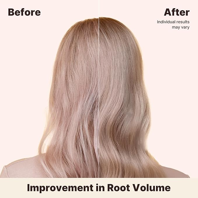 Deep Volumizing Conditioner for Thinning Hair – Korean Hair Care with Biotin & Panthenol – Damage Repair, Elasticity & Strength – White Tea Mandarin Scent, 16.9 fl oz