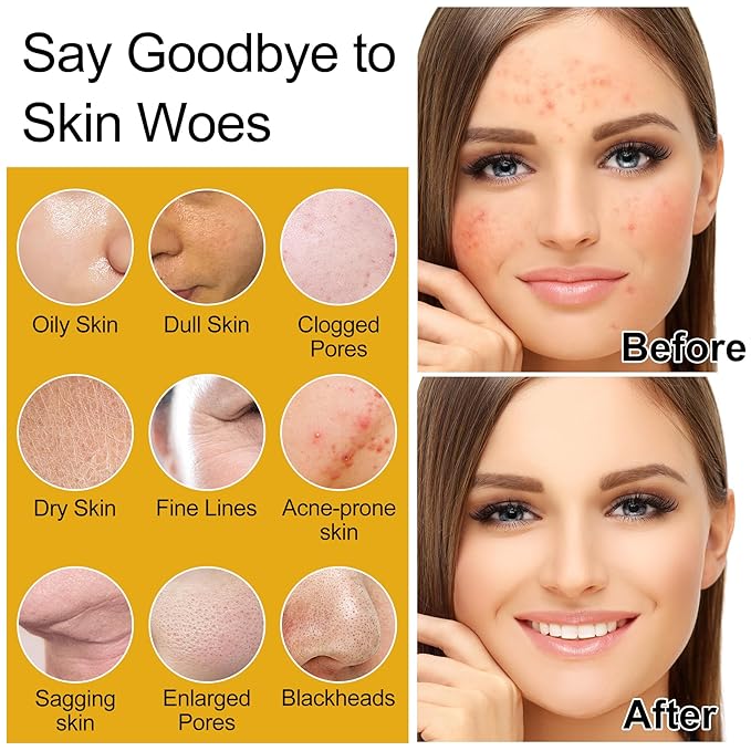 Skin Care Set,Women Teen Glass Skincare w/ Korean Rice Extract,Hydrate Glow Repair Anti-Aging Facial Routine Kit Gift Set for Womens Teens Girl Mom Wife Valentines Christmas Gifts Stocking Stuffers