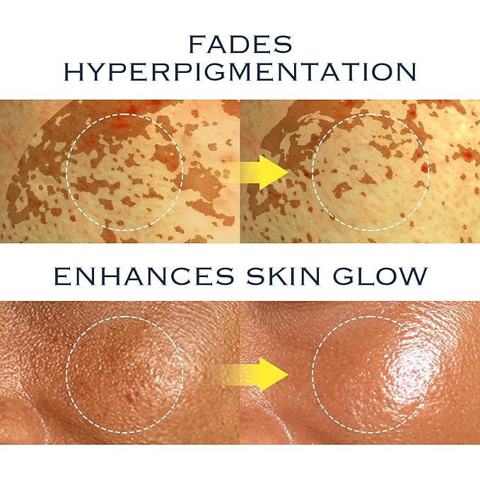 NIACINDY Radiance Capsule Cream | Liposomal NAD + 10% Niacinamide +Thioctic Acid | Dark Spot Remover & Anti-Aging Moisturizer | Korean Clinical Formula for Radiant Skin | 50ml / 1.59 FL OZ