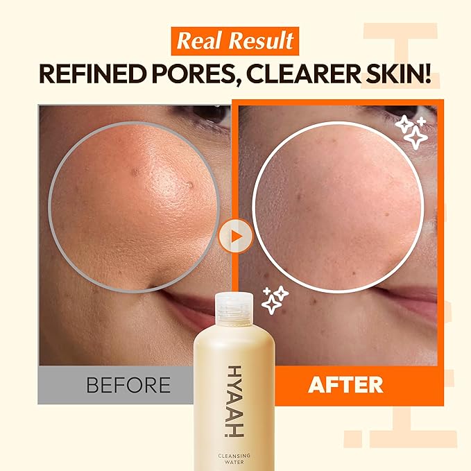 Mild But Deep Cleansing Water - Micellar Water Makeup Remover Oil Free Facial Cleanser for Sensitive Skin - Gently Exfoliates, Hydrates - Korean Skincare, 10.14 fl.oz.